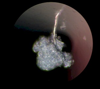 Photomicrograph of Mold